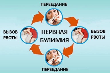 Лечение булимии в Морозовске